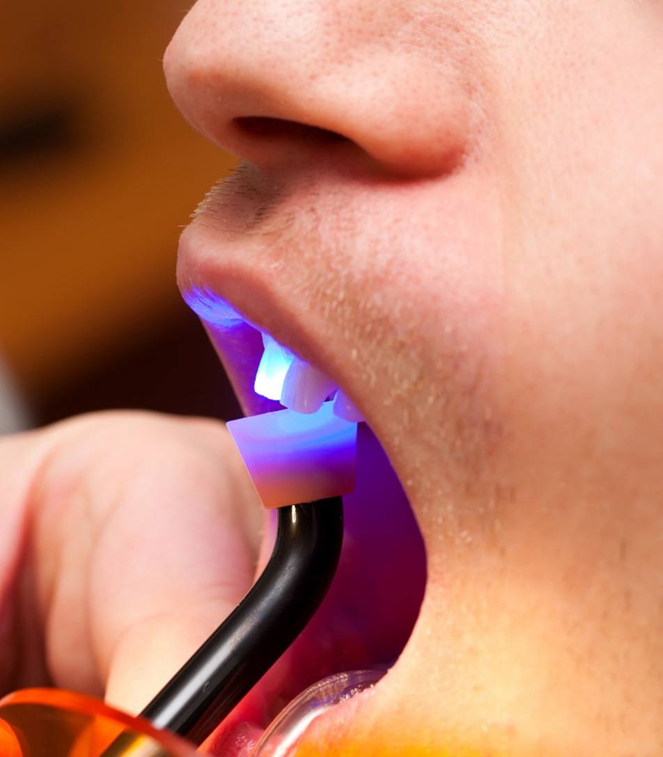 Light being shined on a tooth