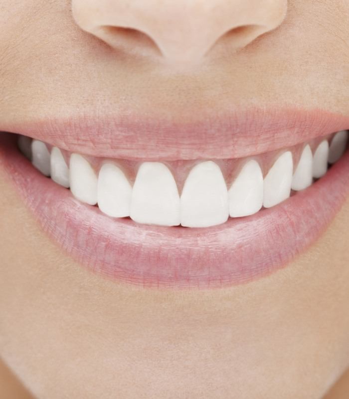Closeup of flawless smile after metal free dental crown