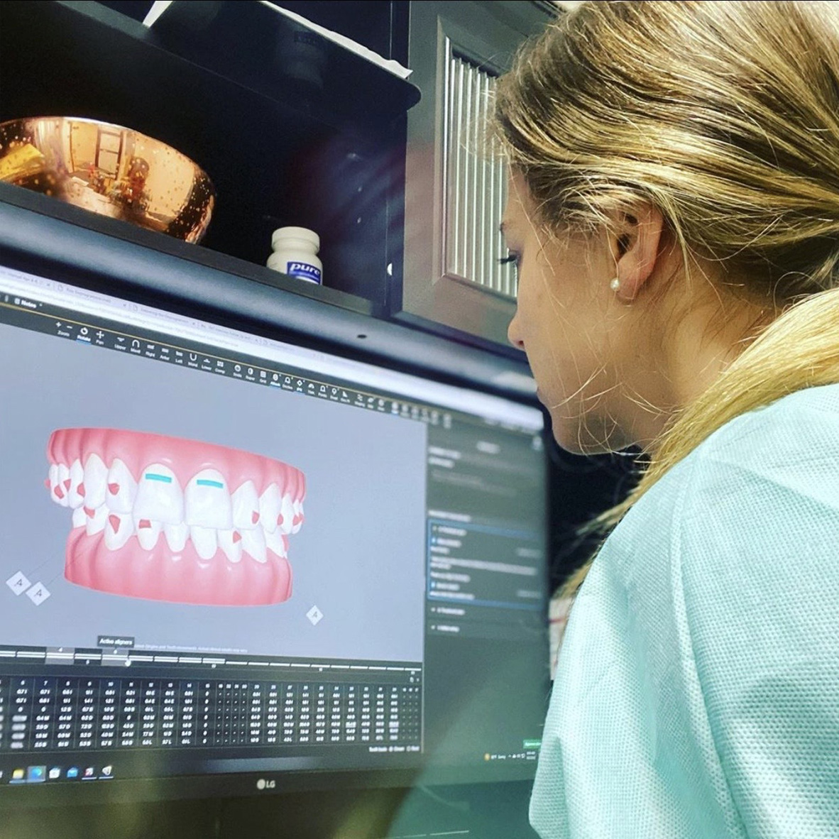 Dental team member in Royal Palm Beach looking at digital bite impressions