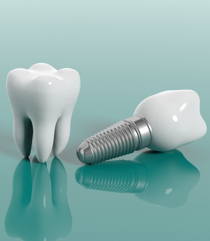 Model tooth and dental implant supported replacement tooth