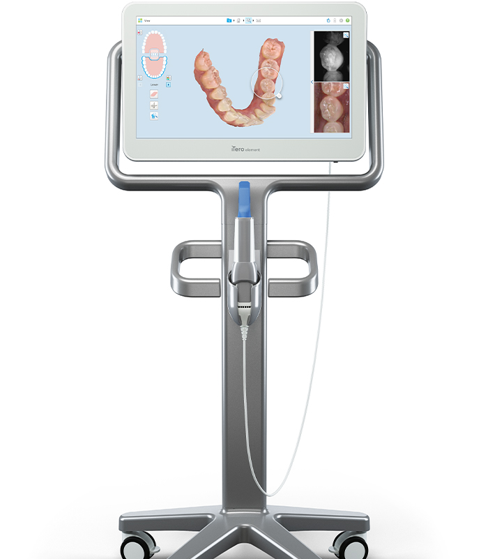 Digital bite impressions used for Invisalign treatment planning