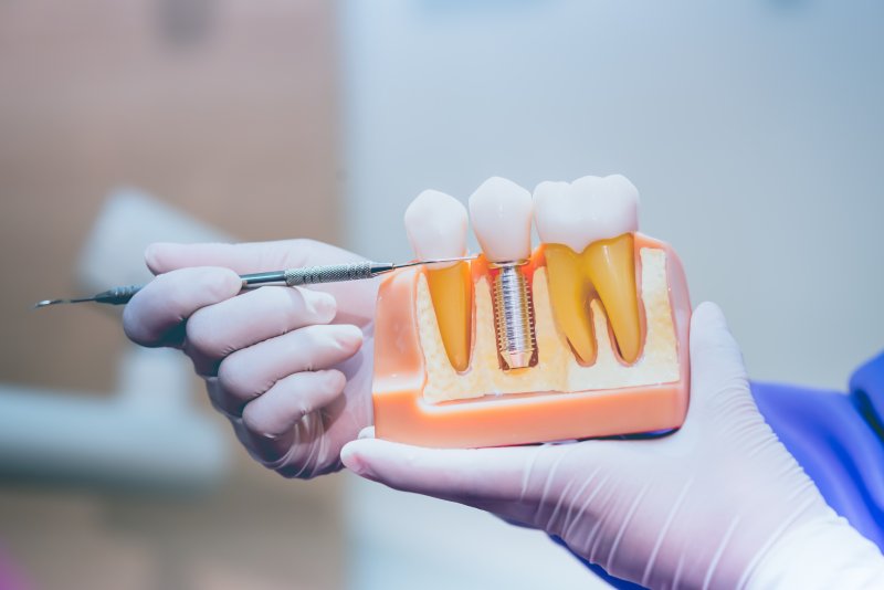 Patient talking with dentist about dental implants