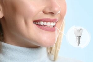 Woman with a dental implant smiling